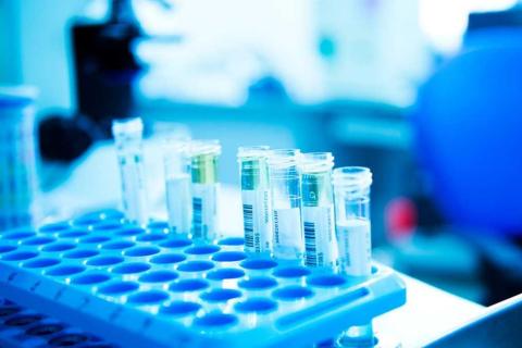 Memphasys hits the mark with horse fertility tests