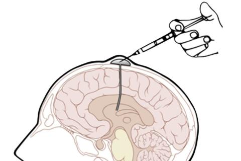 Chimeric closes in on cancer fighting technology