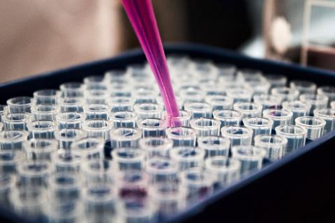 NeuroScientific boss resigns after trial fail