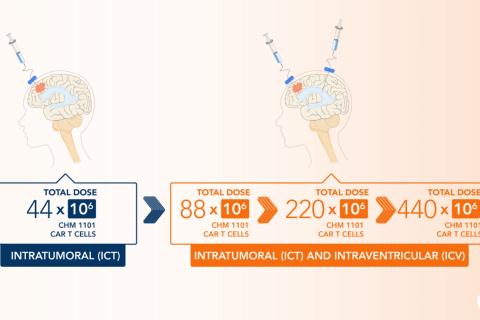 Chimeric moves US brain cancer trial to next stage