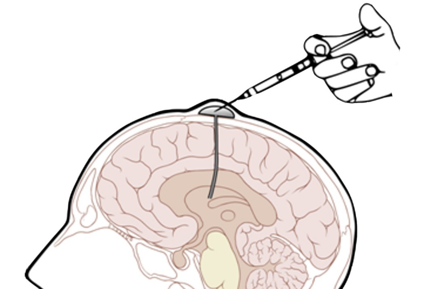 Chimeric closes in on cancer fighting technology